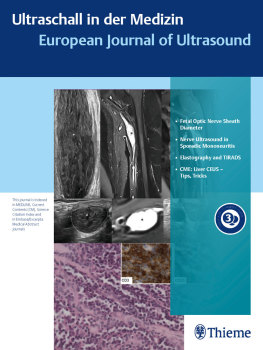 Ultraschall in der Medizin - European Journal of Ultrasound Cover