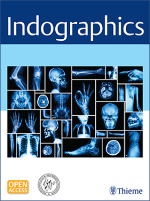 Indographics Cover